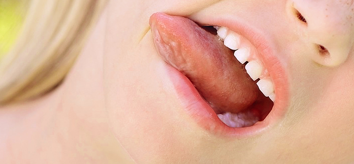 L'erosione dentale si combatte in tre passi