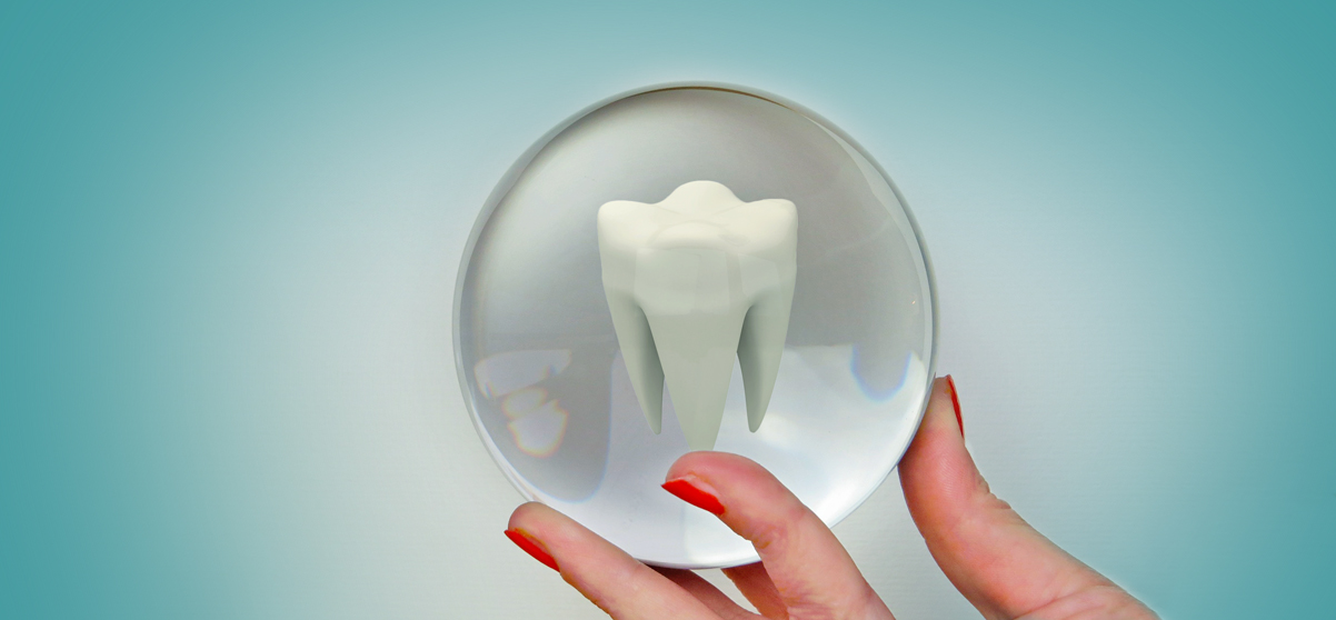 Odontoiatria Conservativa: salvaguardare il dente naturale