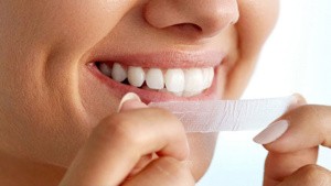 Denti bianchi dai rimedi fai da te ai trattamenti professionali