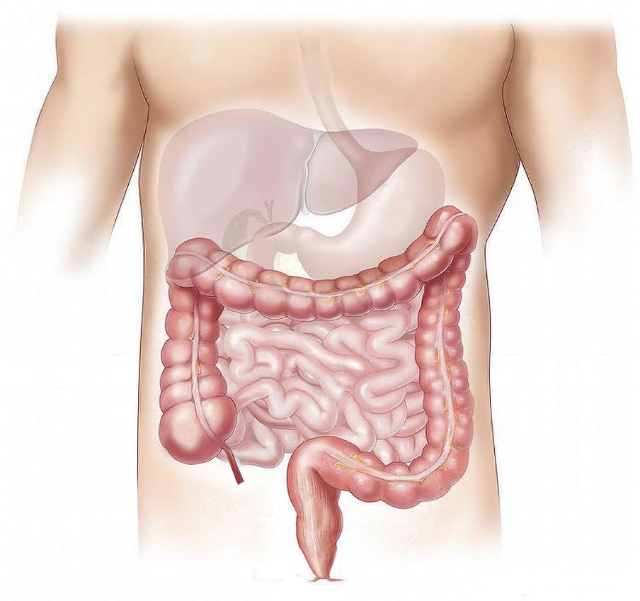 Sindrome da intestino irritabile e cibi FODMAP