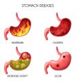 Acidità di stomaco cause e prevenzione (2)