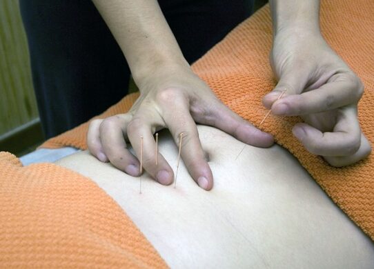 Agopuntura durante la gravidanza benefici e utilizzo