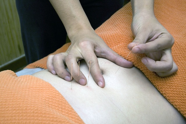 Agopuntura in gravidanza: benefici