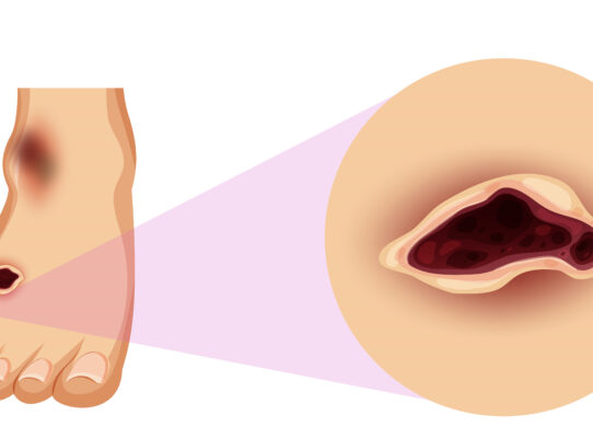Cause delle ulcere agli arti inferiori approccio clinico