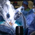 Chirurgia-robotica-e-tumore-alla-prostata-indicazioni-e-vantaggi