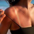 Cura della pelle dopo esposizione al sole consigli essenziali per una pelle sana e luminosa