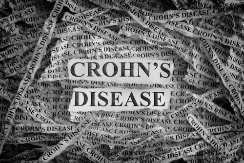 Il morbo di Crohn: le cure mediche e chirurgiche