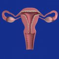 Infertilità ed endometriosi