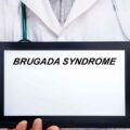 La sindrome di Brugada, in cosa consiste e come si presenta