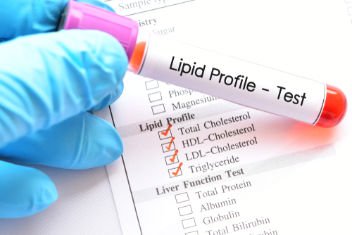 Lipidi: cosa succede quando il valore è alterato?