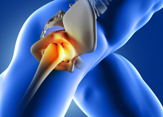 Protesi anca vantaggi e procedure della via anteriore