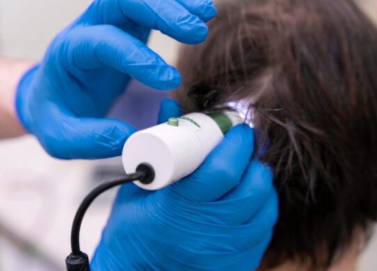 Risolvere i problemi di capelli l'importanza dei test e della consulenza professionale