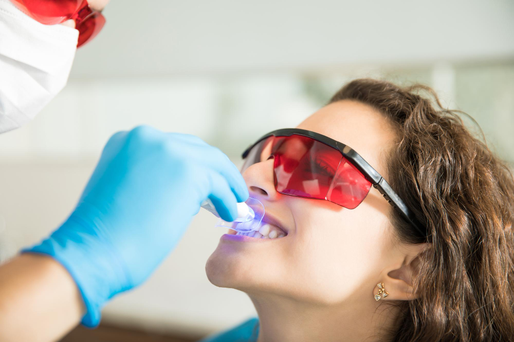 Sbiancamento Dentale: illumina il tuo sorriso con un trattamento efficace e sicuro
