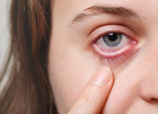Sindrome dell’occhio secco Ecco come fare per evitare tale fastidio