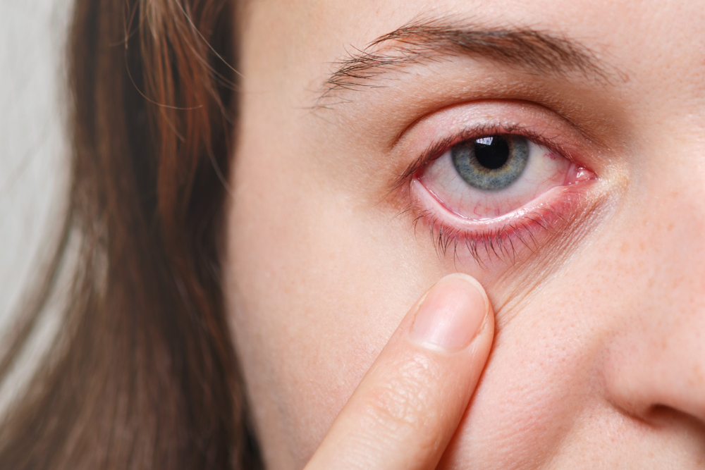 Sindrome dell’occhio secco? Ecco come fare per evitare tale fastidio