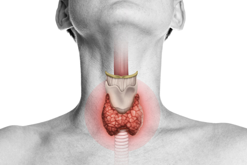 Il tumore della tiroide: sintomi e cure