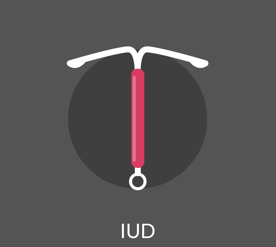 L’efficacia e le caratteristiche dell’impianto intrauterino (IUD o spirale) come metodo di contraccezione